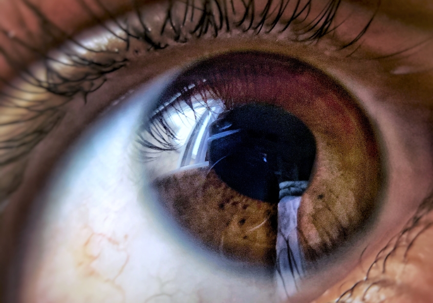 La couleur des yeux peut-elle avoir un impact sur la vision et la santé? -  Détail du blogue - IRIS