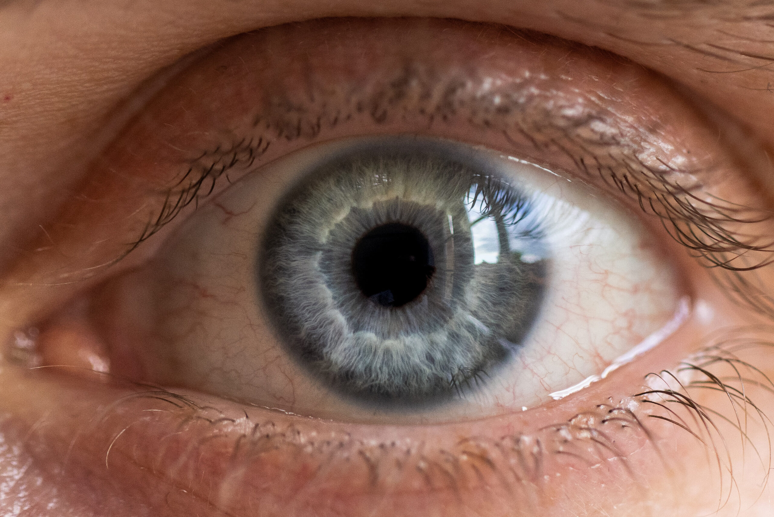 Changer la couleur de ses yeux - Institut Pasquier à Paris